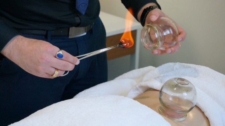 Cupping Therapy in Melbourne: Unlock Healing Benefits Today
