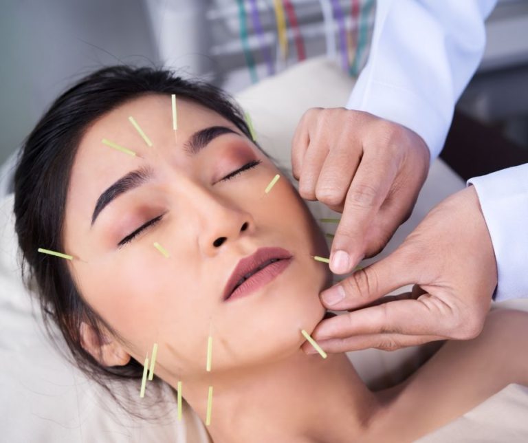 Cosmetic Acupuncture: Important Drawbacks to Evaluate
