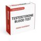 Hair Loss Blood Test: Key Insights for Epsom Locals